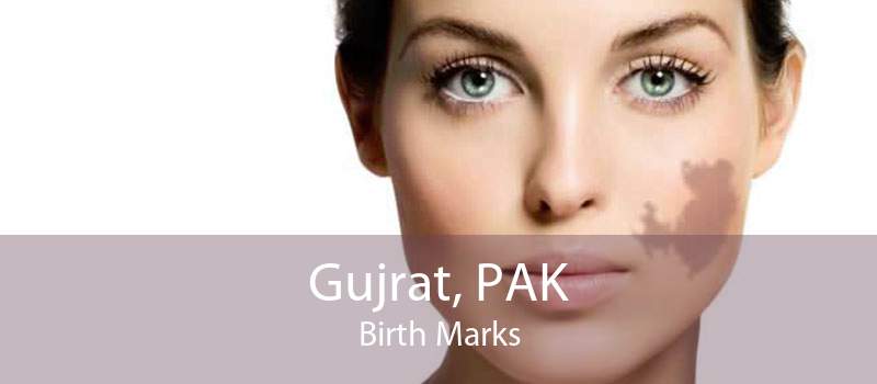 Gujrat, PAK Birth Marks