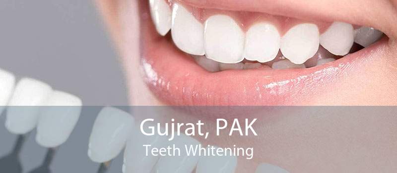 Gujrat, PAK Teeth Whitening
